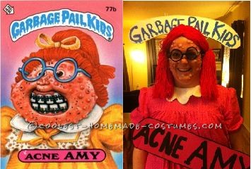 Totally Gross Homemade Costume: Acne Amy POPS up on Halloween