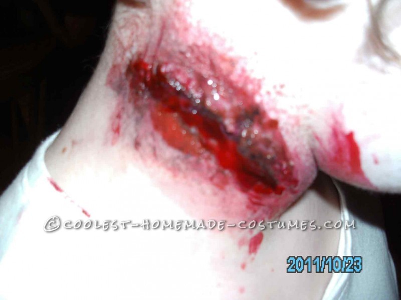 Neck Wound