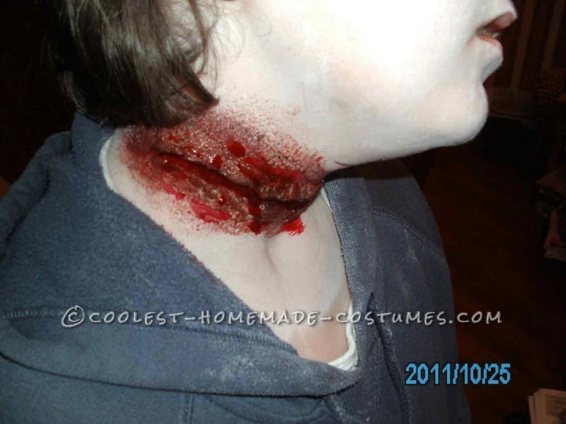 Neck Wound