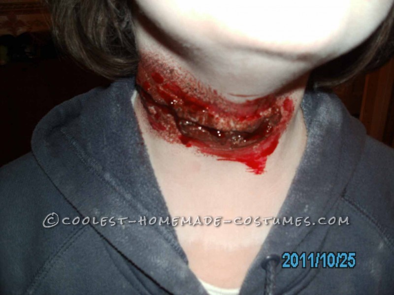 Neck Wound